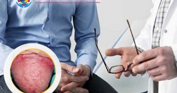Quy đầu có các nốt đỏ có phải bị viêm bao quy đầu không?